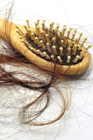 Hair Replacement System at Top Hair Loss Clinic in Lincolnshire